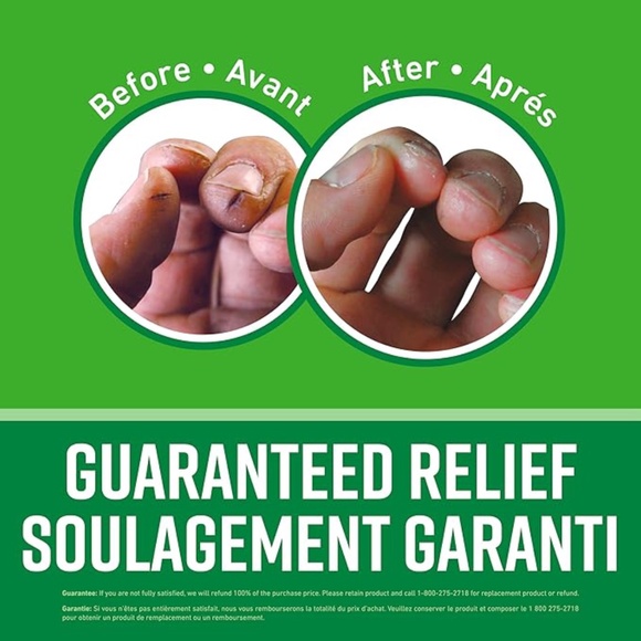 O'Keeffe's Working Hands Hand Cream for Extremely Dry, Cracked Hands - Picture 2 of 6